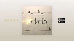 Вадяра Блюз - Вверх