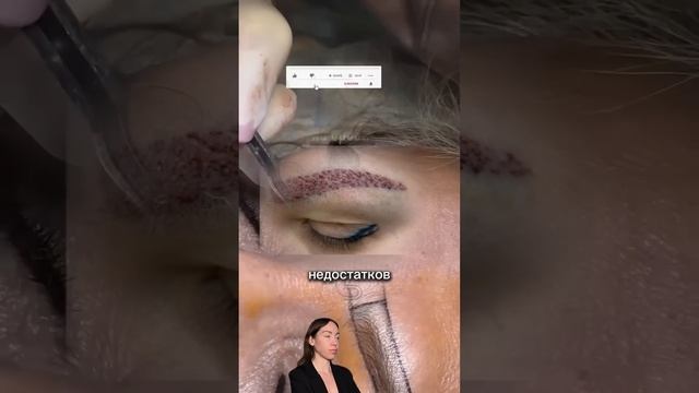 Как отрастить брови, пересадка волос #обучениекосметологов #пересадкабровей  #пересадкаволос