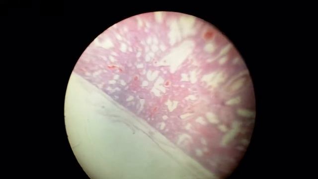 Недышавшее легкое смотреть онлайн