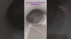 Мочевой камень, борьба продолжается
