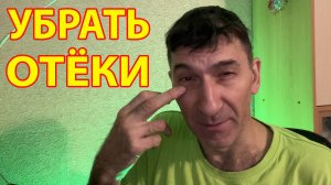 Как убрать отеки и синяки под глазами