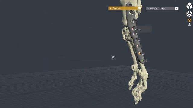 Глава 2 Артродез заплюсны смотреть онлайн