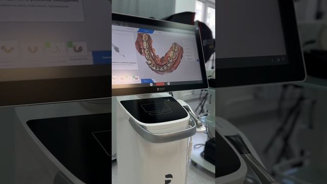 CEREC prime scan