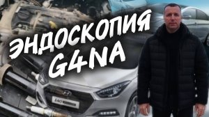 Эндоскопия двигателя 2.0 G4NA Hyundai i40. #а30автоподбор