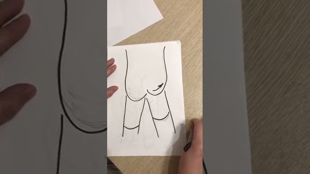 Дисплазия ТБС