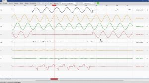 Анализ осциллограмм. Задание 1