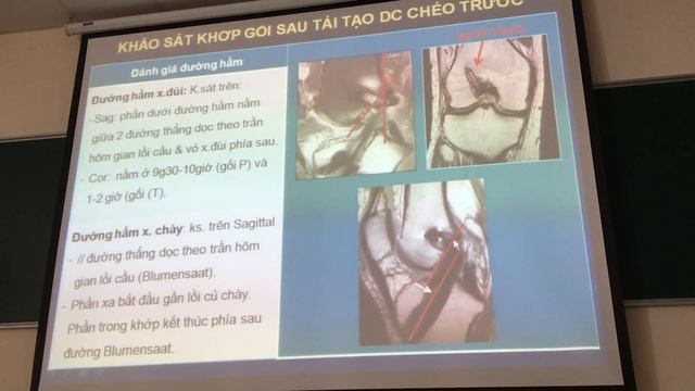 MRI GỐI BSHA P3