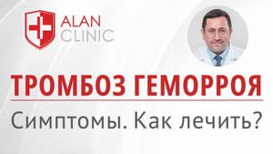 Тромбоз геморроидального узла – симптомы, как лечить