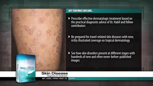 Skin Disease: Diagnosis and Treatment, 3rd Edition