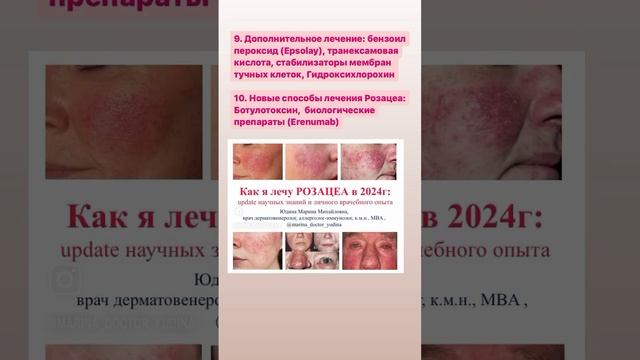 Новое по РОЗАЦЕА