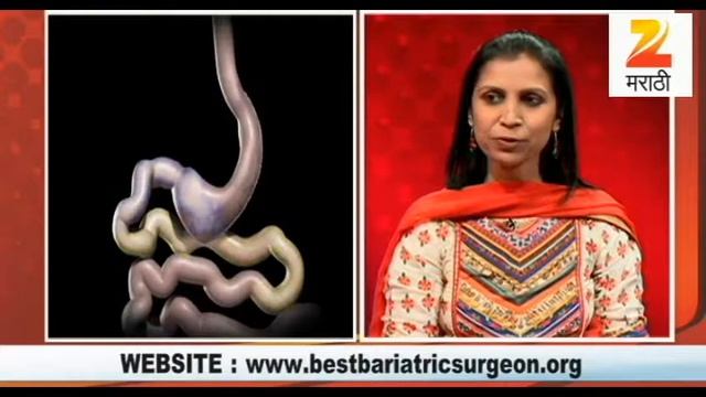 Zee Marathi- Dr. Aparna Govil Bhasker- Treatment options for obesity and bariatric surgery смотреть онлайн