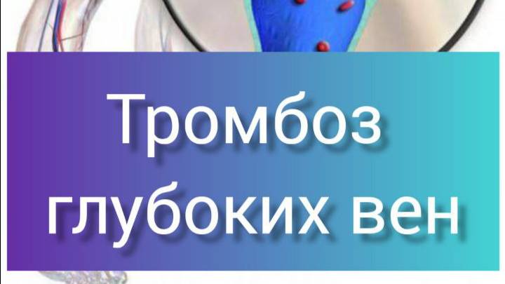 Тромбоз глубоких вен