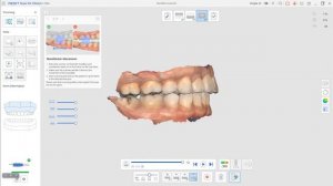 Перенос динамической окклюзии из MEDIT в ExoCad