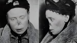 Сифилис. Как позорная зараза пожирала Европу и Россию