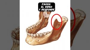 Anatomía-Apófisis Coronoides del maxilar inferior.