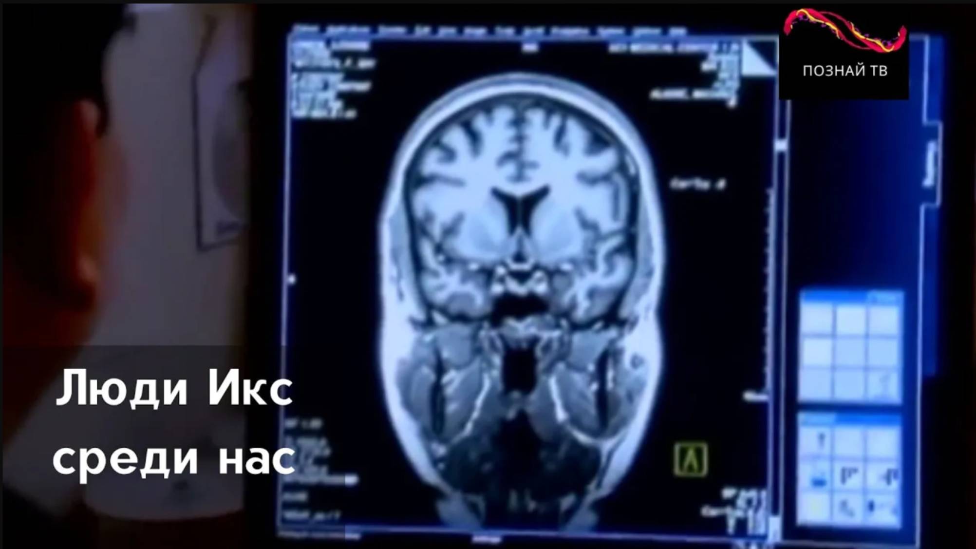 Люди Икс среди нас смотреть онлайн