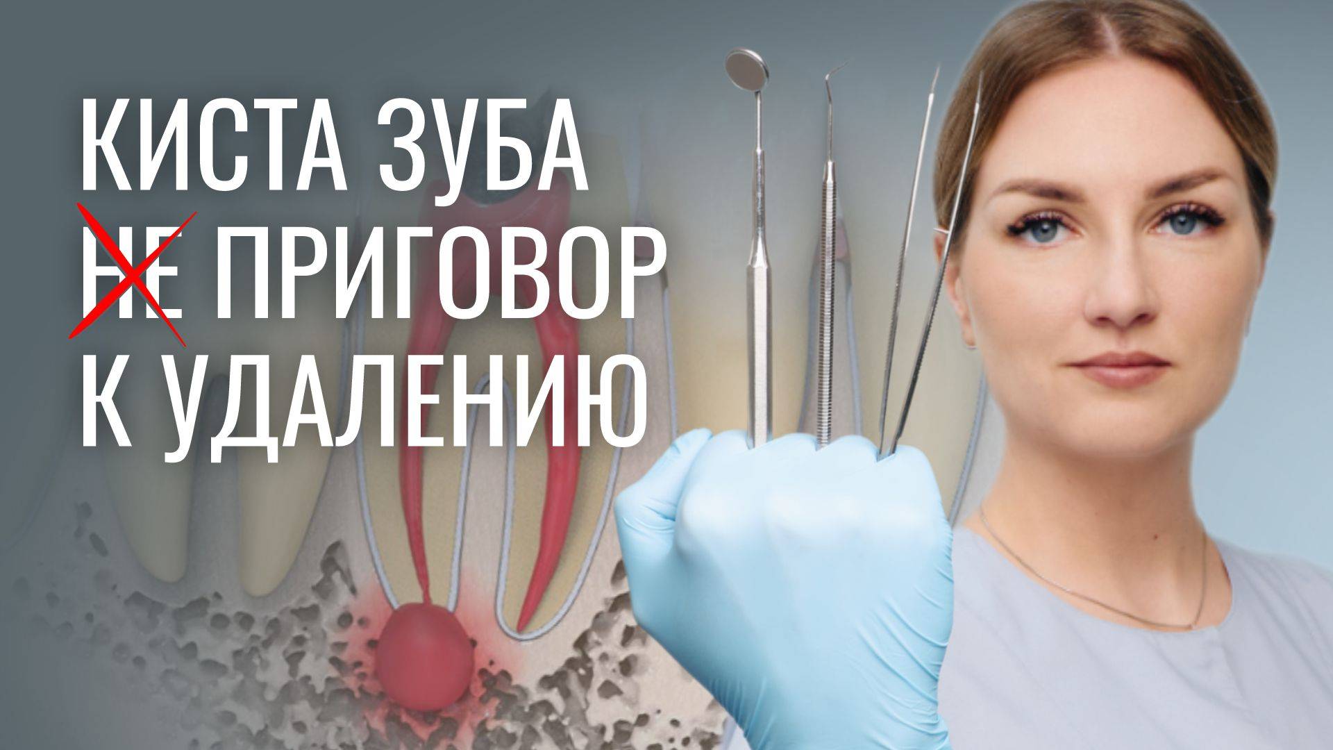 КИСТА! Спасать или удалять зуб