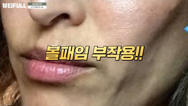 수술없이 남들 모르게 예뻐지는 가장 효과적인 시술 3가지 смотреть онлайн