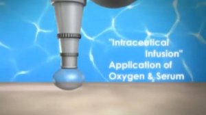 Dermascience O2 Intraceuticals Hyperbaric Oxygen Technology