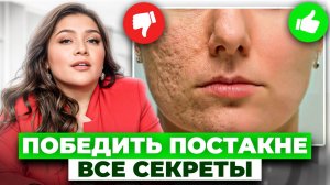 Как избавиться от пятен и рубцов от прыщей? / ТОП бюджетных средств, которые реально работают!