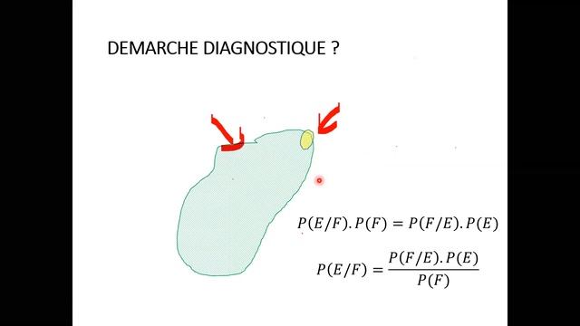 Endocardite infectieuse _ 4ème année médecine S2_ Unité Cardiovasculaire & Respiratoire _ 31/01/202 смотреть онлайн