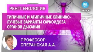 Типичные и атипичные клинико-лучевые варианты саркоидоза органов дыхания