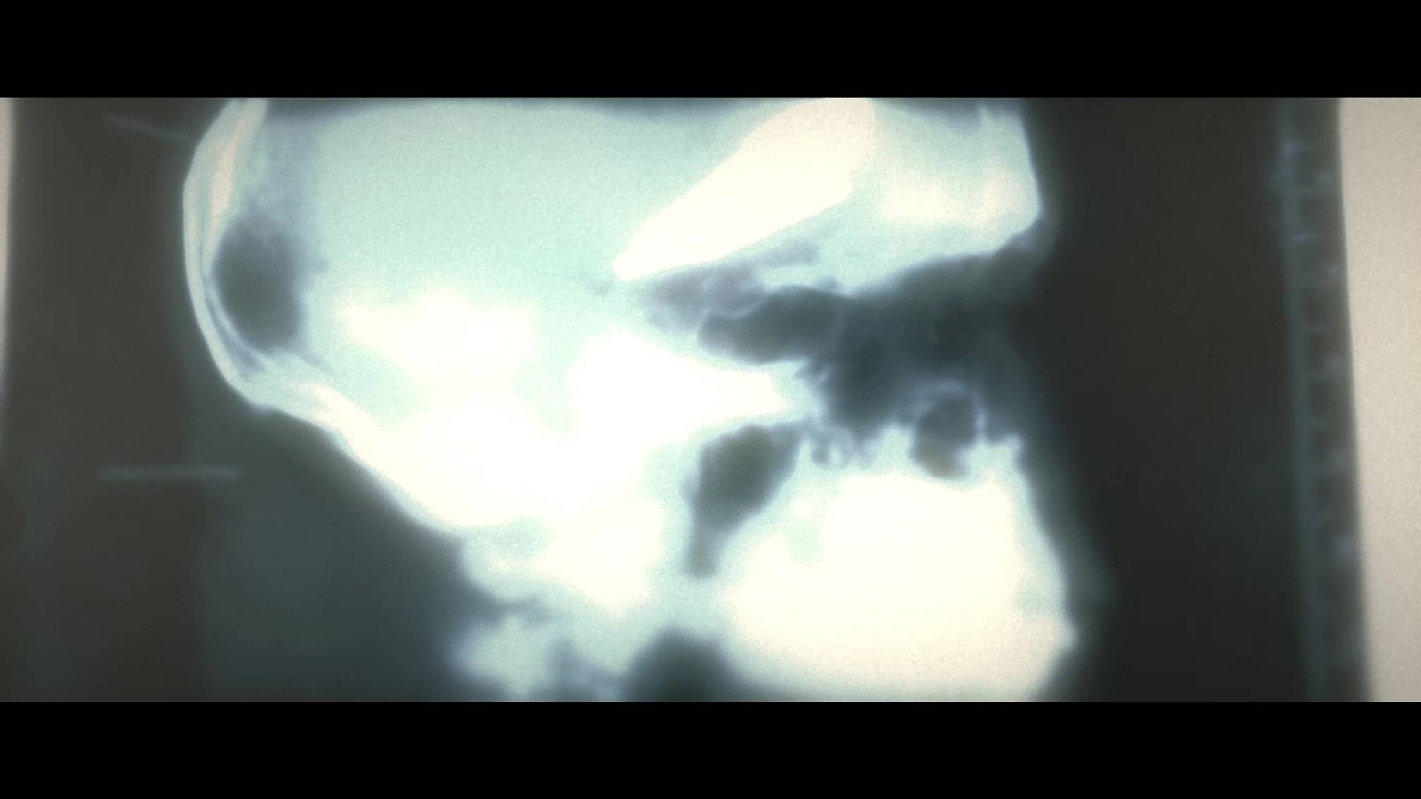 Wolfenstein: The New Order - Глава 2 / Лечебница