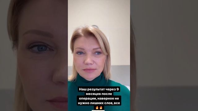 Фейслифтинг | платизмопластика | блефаропластика | эндоскопическая подтяжка лба