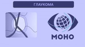 Лечение глаукомы. Лазерное и хирургическое лечение глаукомы. Диагностика. 2-ое заседание МОНО.