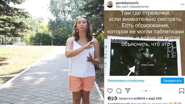 💥Долгожданная беременность и 70 драже в день!