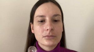 Аппарат Дарсонваль для лица