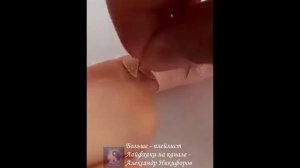 Лайфхак. Так пластырь не ограничит ваши движения
