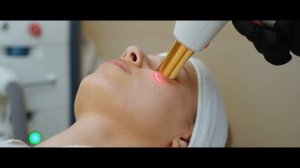 Лечение кожи на аппарате M22 (IPL)