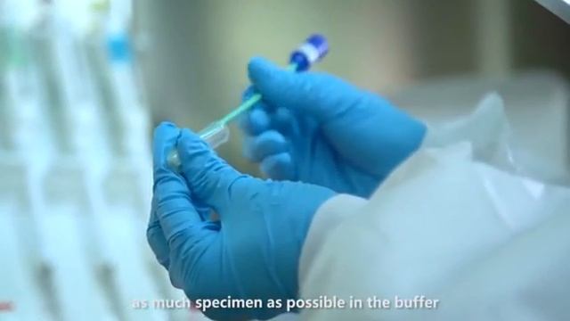 SOP of Wondfo 2019-nCoV Antigen Test смотреть онлайн