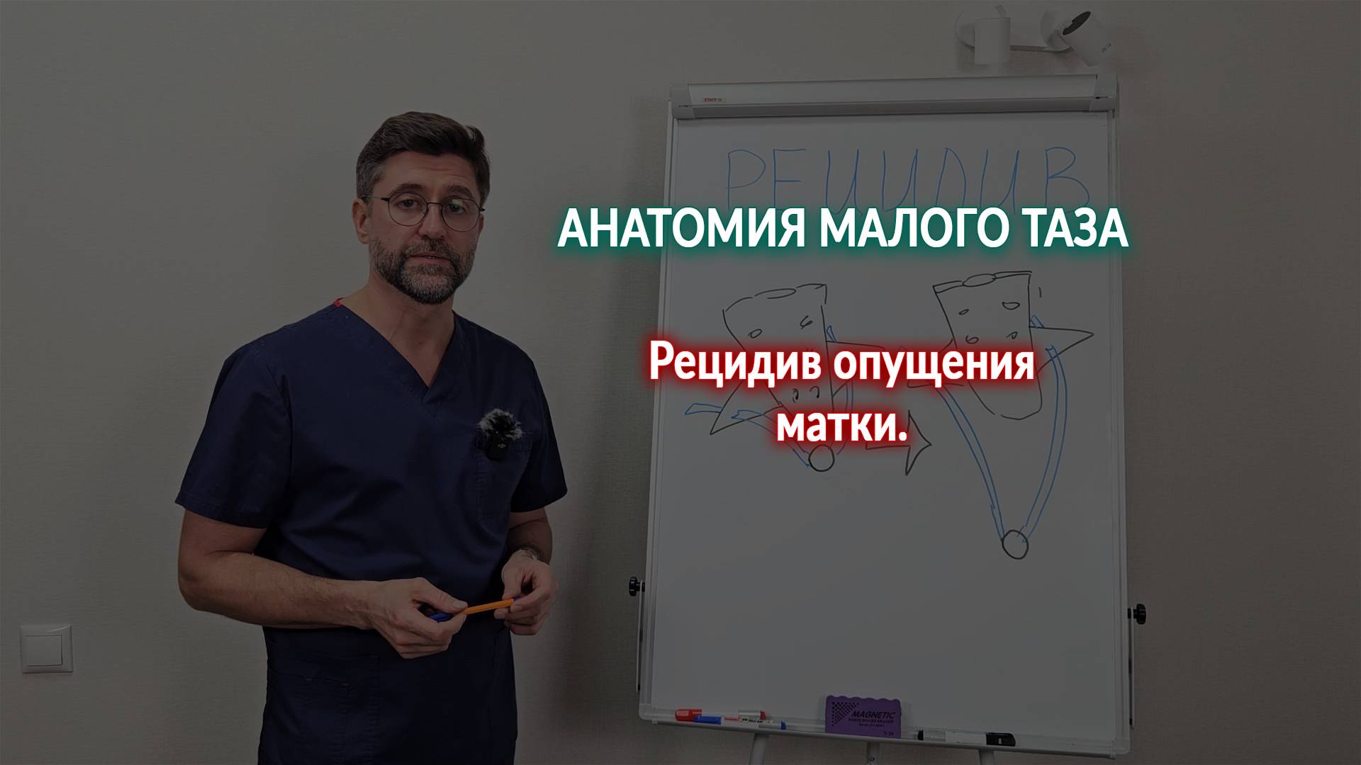 Рецидив опущения матки