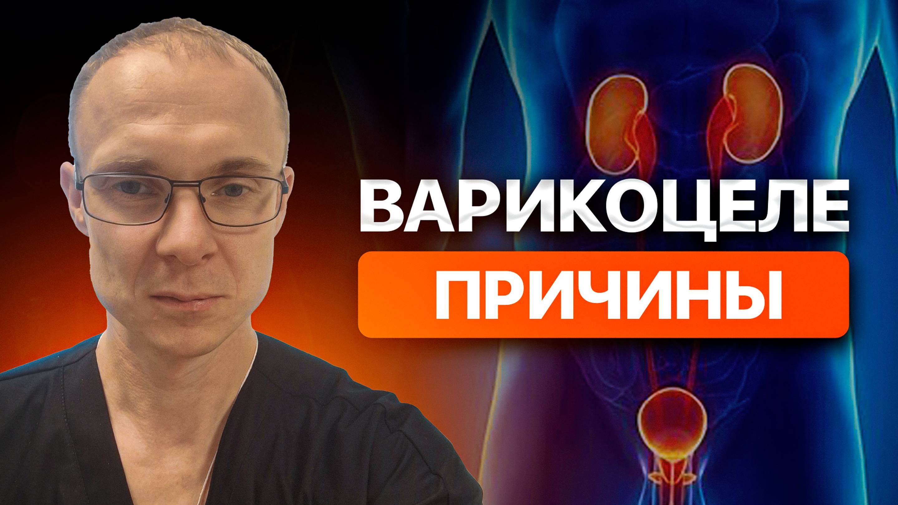 Варикоцеле причины. Врач уролог-андролог. Москва