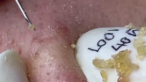 Enjoy Every Day With The Best Video Loan Nguyen Spa Official  2496