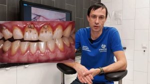 Почему зубы меняют цвет? 🦷✨