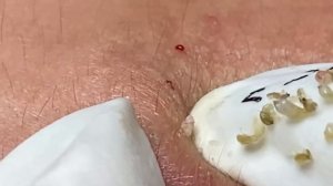 Enjoy Every Day With The Best Video Loan Nguyen Spa Official  2628