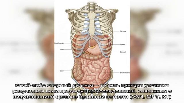 Как делается и что показывает биопсия печени смотреть онлайн