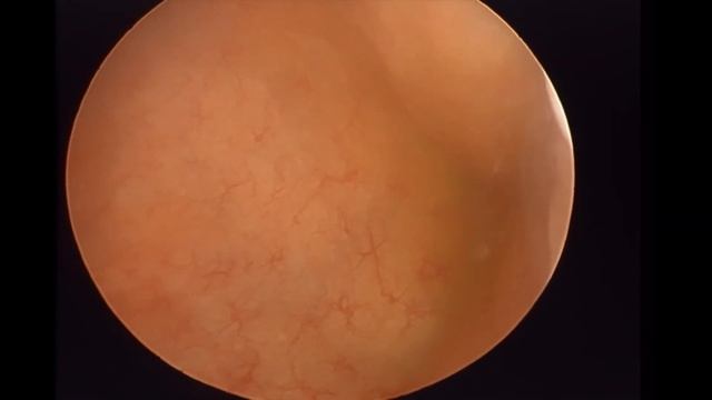 Цистоскопия у собаки смотреть онлайн