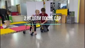 СДР – две недели после операции