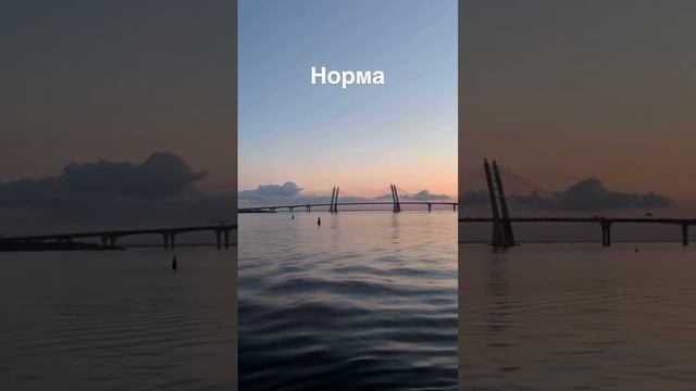 КАК ВИДЯТ ЛЮДИ С НИСТАГМОМ? А вы знаете? Что такое нистагм? #офтальмолог #нистагм