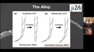 CE Webinar: Safe and Efficient Preparation of Complex Root Canal System