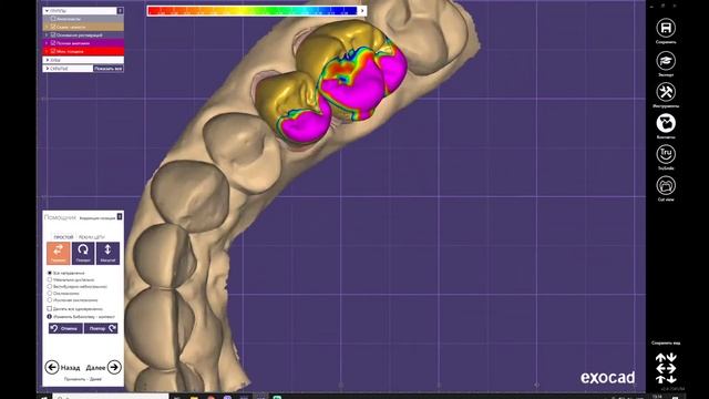 EXOCAD №6 Plovdiv  Full Anatomy 25-26 dent /Exocad повна анатомія 25-26 зуба / EXOCAD 2022 /
