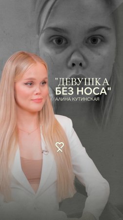 Куда делся нос? Жертва пластики? Как выжить в мире хейта. Смотрите новый выпуск на нашем канале