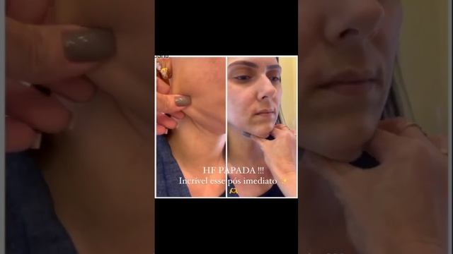 Não perca a chance de dar uma espiadinha e se inspirar nessa transformação -Kellen Cristina Estétic смотреть онлайн