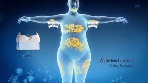 КРИОЛИПОЛИЗ НОВОГО ПОКОЛЕНИЯ НА СОВРЕМЕННОМ АППАРАТЕ CLATUU