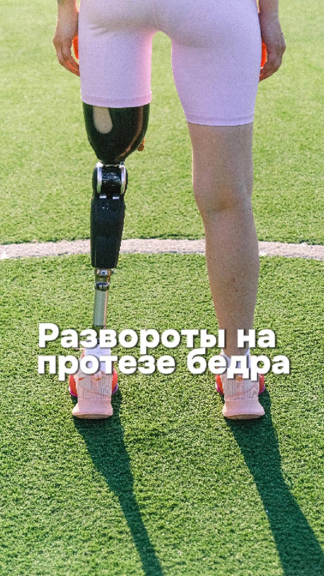 Развороты на протезе бедра