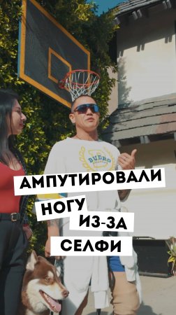 Ампутировали ногу из-за селфи! Kima Dima